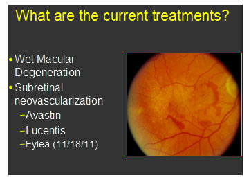 List of treatments for Macular Degeneration