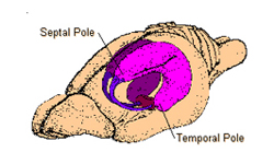 Location of the hippocampus in the adult rat brain