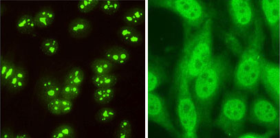 Image of prototypical antibodies in mHgIA