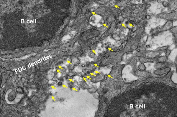 Electron Microscopy