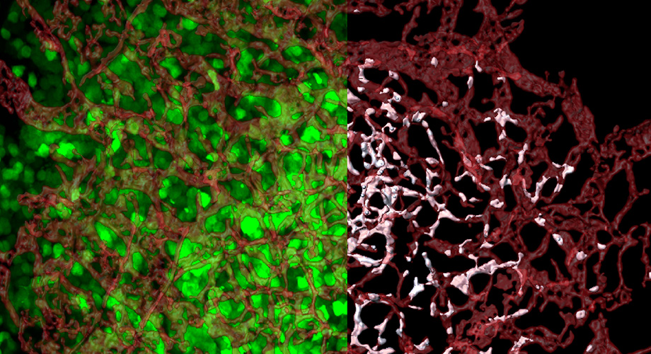 On the left, stained red blood vessels weave between florescent green tumor cells. On the right, the researchers have mapped exactly where tumor cells (white) have entered blood vessels. The image shows that more cells enter blood vessels in the tumor's core than its invasive border. (Image from Elena Deryugina and William Kiosses.)