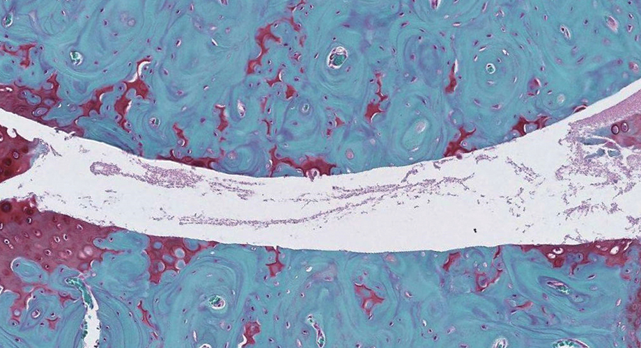 Images of knee joints from control and FoxO deficient mice. The areas in red are joint cartilage which is destroyed in FoxO deficient mice after treadmill running. (Lotz Lab, The Scripps Research Institute)