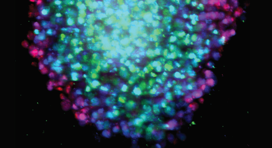 The researchers used a technique called confocal microscopy to confirm that the cell lines were forming spheres. Above: is the BxPC-3-KRASWT cell line. (Credit: Kota et. al. / The Scripps Research Institute)