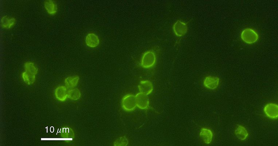 An immunofluorescent image of Cryptosporidium parvum oocysts. Courtesy: U.S. Environmental Protection Agency