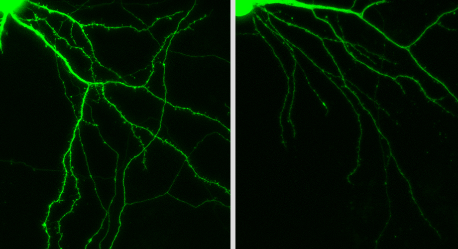 Left: A control neuron shows normal branching. Right: A GM12371 knockdown shows sparse branching. Credit: Puthanveettil lab, Scripps Research