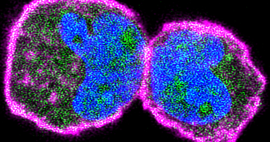 Fluorescent images of cells expressing talin mutants. Courtesy Izard laboratory, Scripps Research