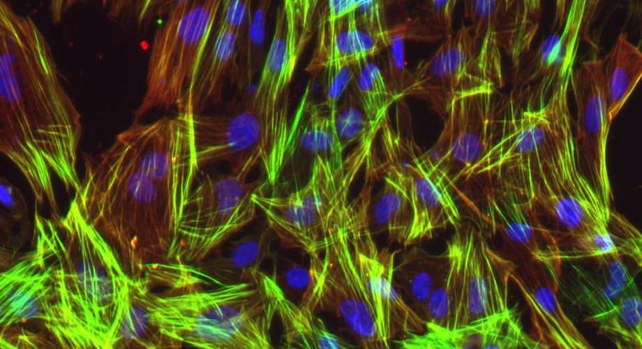 Microscopy image showing vascular smooth muscular cells made from blood-derived induced pluripotent stem cells. The Scripps Research team found that a deleting genetic risk factor for coronary artery disease rescued the health of these cells. Credit: Baldwin lab. 