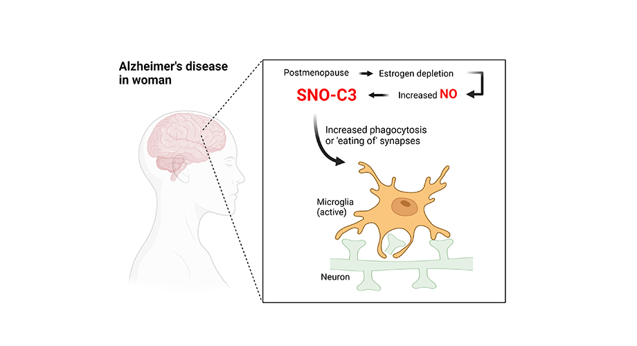 Discovery could explain why women are more likely to get Alzheimer’s (scripps.edu)