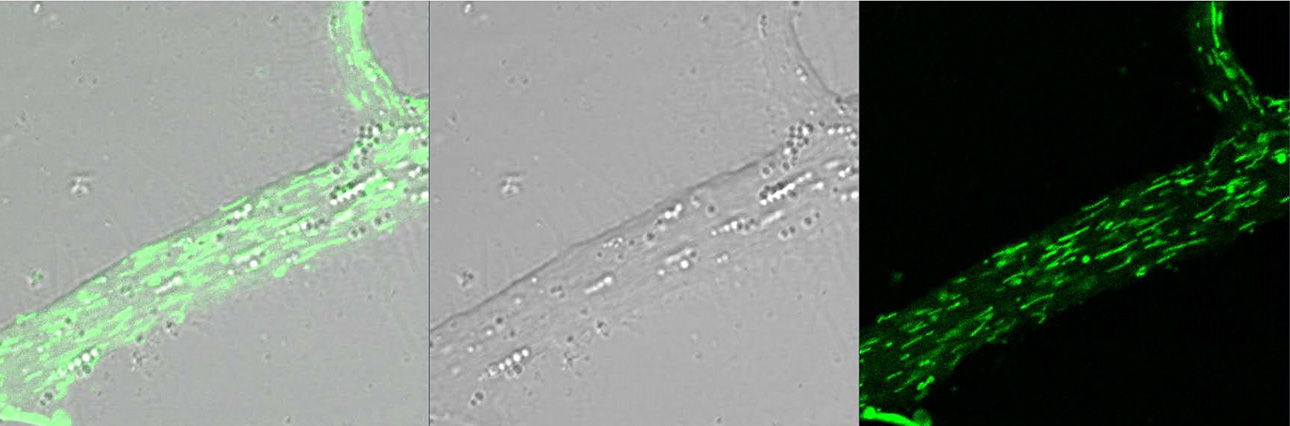 Mictochondrial Transport Aplysia Badal