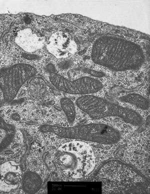 Photo of mitos in neural stem cells