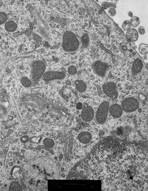 Photo of mitos in neurons