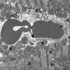 Image of blood vessel containing a single red block cell (RBC)