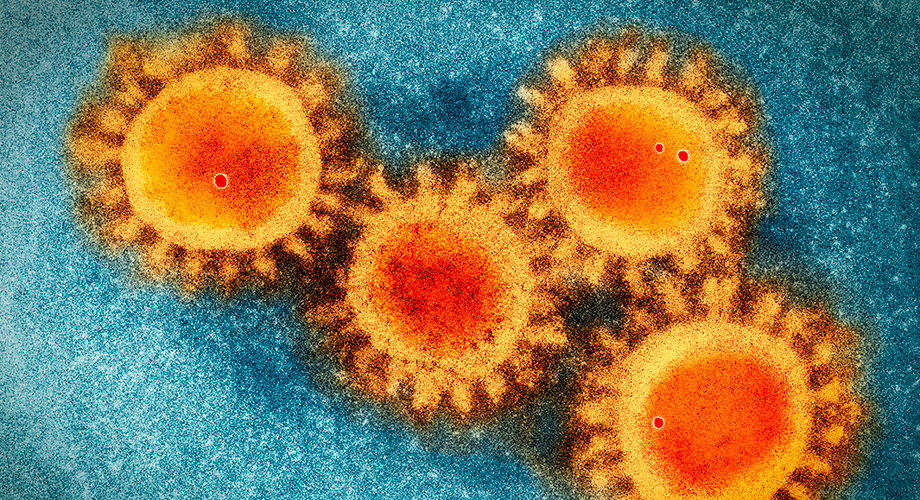 COVID-19: Drug targets enzymes that enable virus to invade cells