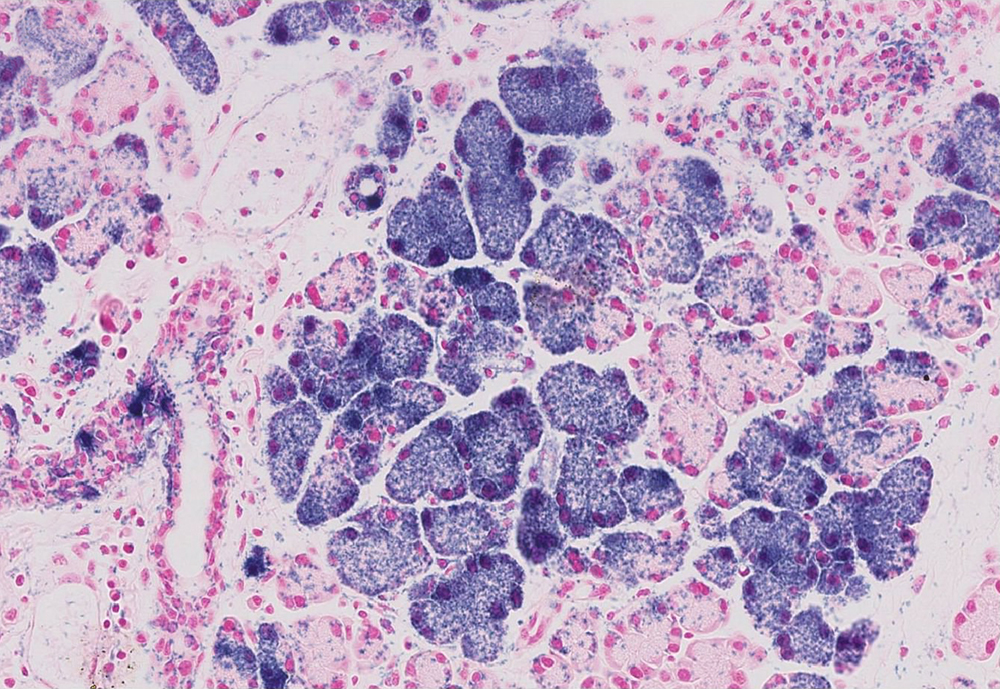 The Scripps Research Institute team found "progenitor" cells isolated from healthy lacrimal glands can improve the appearance and function of diseased tissue. (Image courtesy of TSRI's Makarenkova lab.)