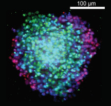 oncogene 1