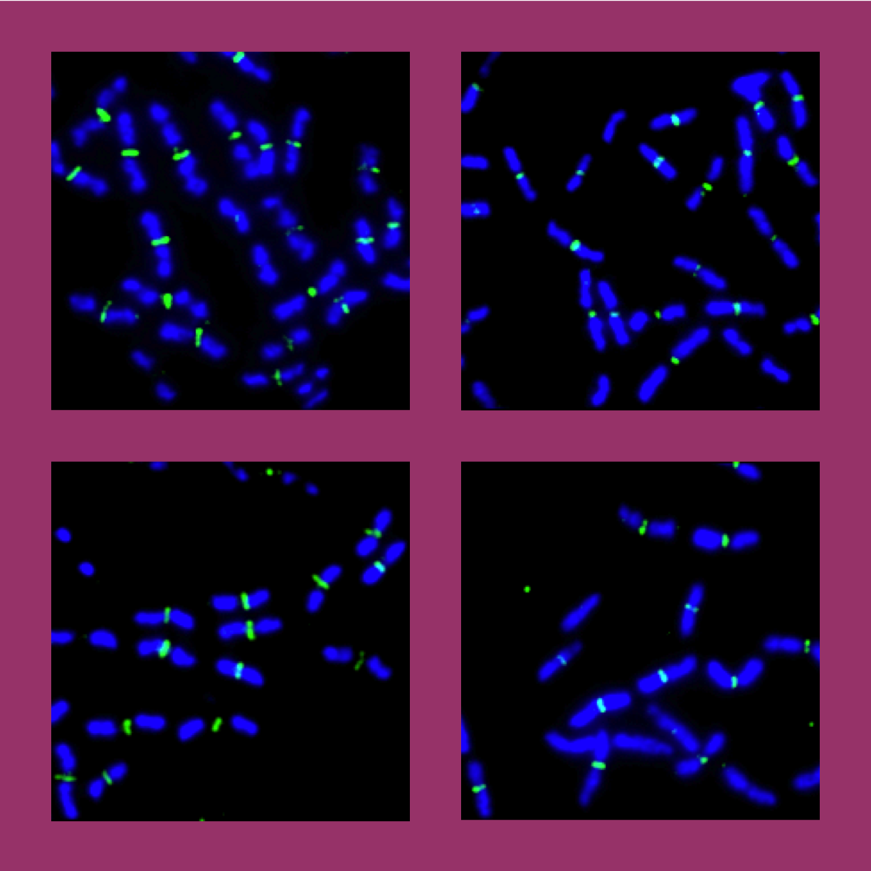 YycG localization in Bacillus subtilis