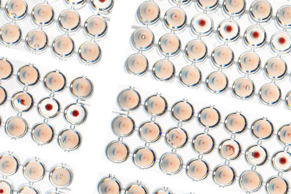 Discovery paves way for better flu prevention, treatment