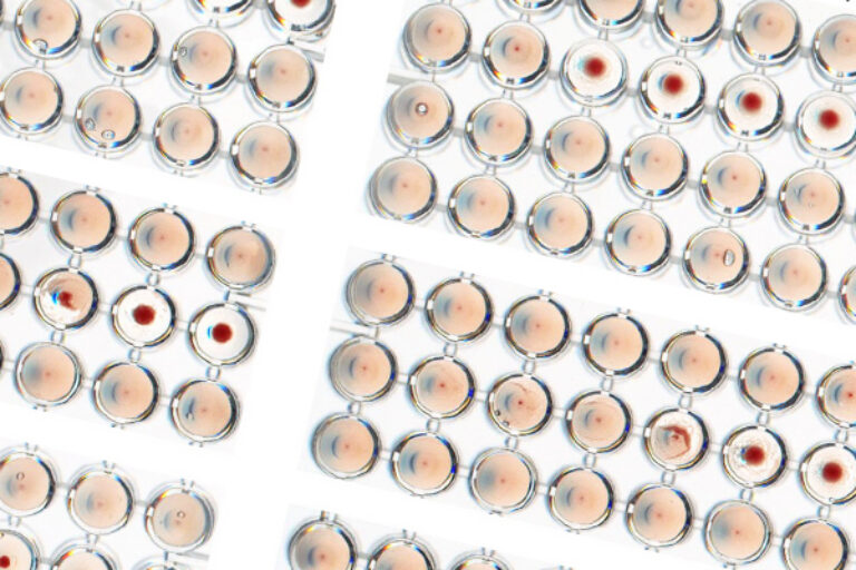 Discovery paves way for better flu prevention, treatment