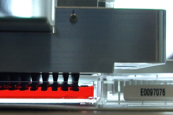 Molecule that dilates blood vessels hints at new way to treat heart disease