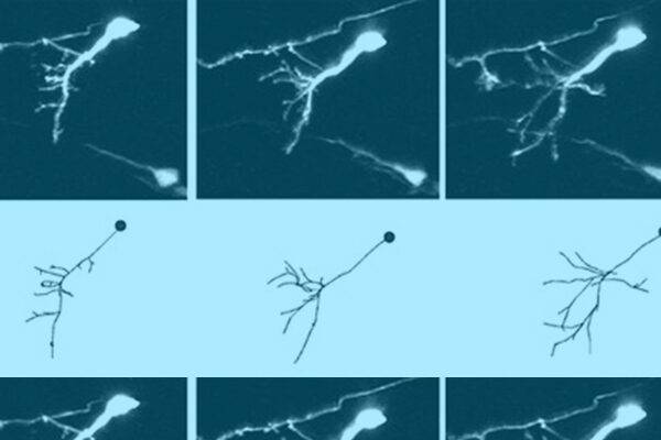 Wriggling tadpoles may hold clue to how autism develops