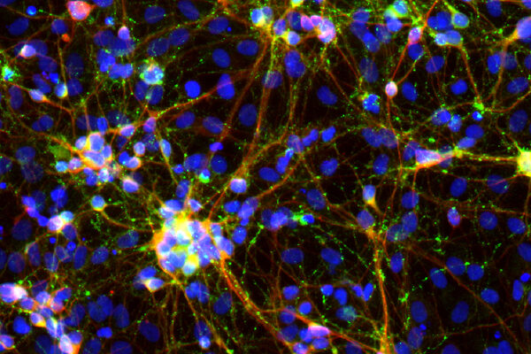 The Joy of Neurons