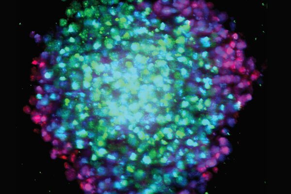 Tumor-like spheres help scientists discover smarter cancer drugs