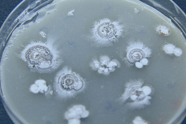 Scientists find potential disease-fighting ‘warheads’ hidden in bacteria