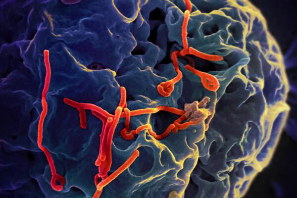 Scientists get first look at T cell responses in Ebola virus survivors