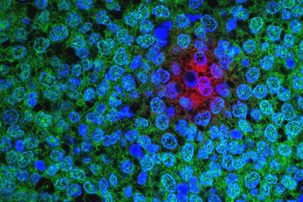 New strategy for cancer therapy spells double trouble for tumors