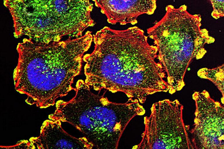 Scientists test new cancer vaccine against melanoma