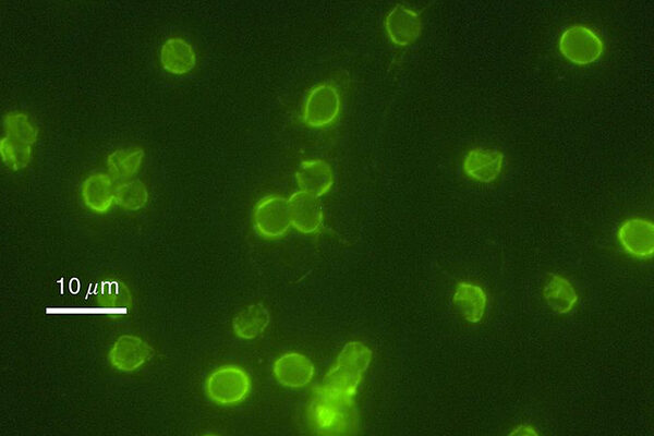 ReFRAME drug repurposing collection yields hope for treating diseases that kill millions worldwide