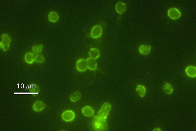 ReFRAME drug repurposing collection yields hope for treating diseases that kill millions worldwide