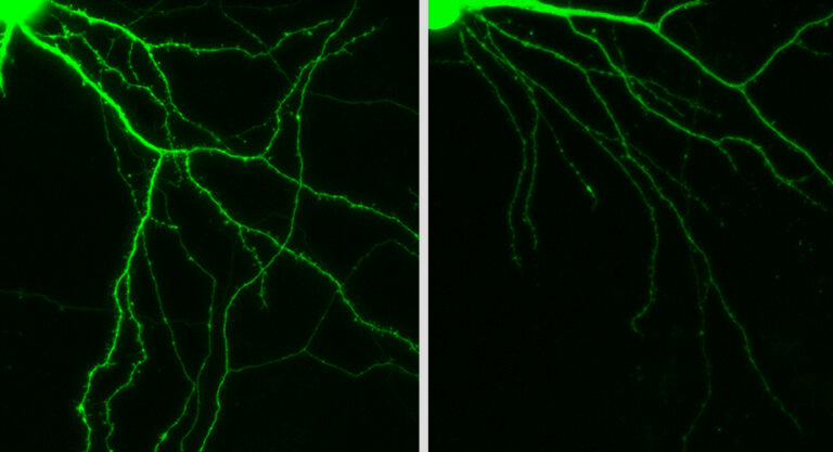 Newly discovered long noncoding RNA plays critical role in brain growth and signaling