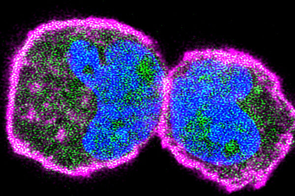 Team gets a closer look at how proteins meet on the cell membrane
