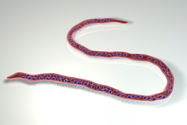 Scripps Research licenses urine dipstick test for river blindness to IVD Research