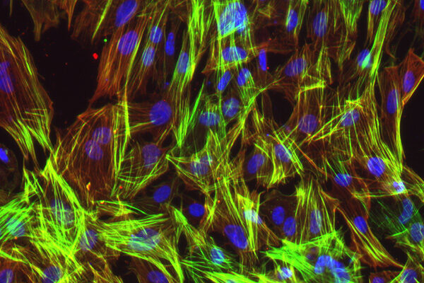 Scientists cut main heart disease risk locus out of DNA by genome editing