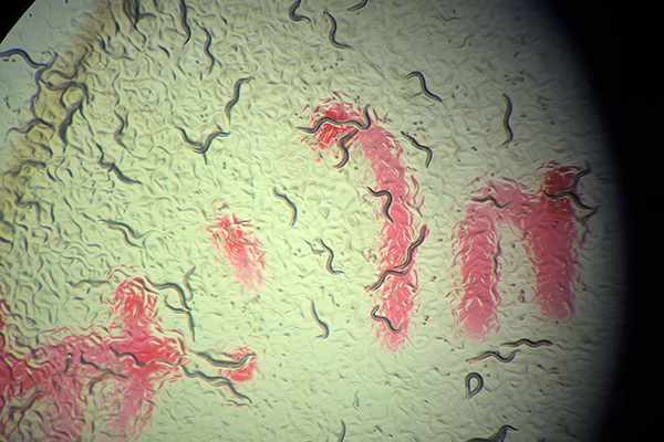 Synapse maintenance depends on network within neurons, study finds