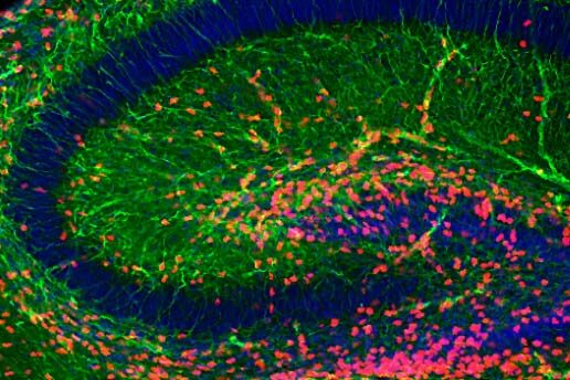 Exosomes may hold the answer to treating, diagnosing developmental brain disorders