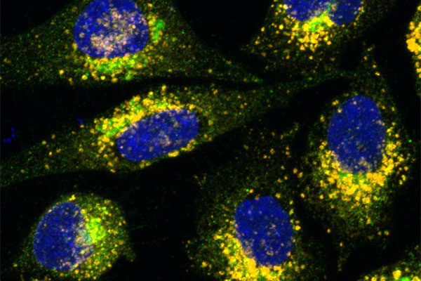 When added to gene therapy, plant-based compound may enable faster, more effective treatments