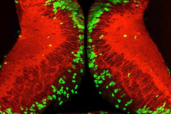 Starvation halts brain development, but hungry cells jump-start growth when food becomes available