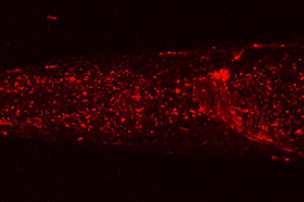 How to kickstart self-cleaning mode in brain cells? Scientists may have solved the puzzle