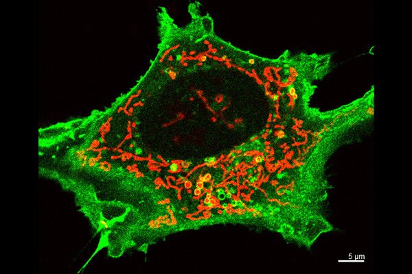 Protein that polices mitochondria in brain’s striatum may underlie Huntington’s selective damage, study finds