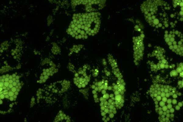 Little-known protein appears to play important role in obesity and metabolic disease