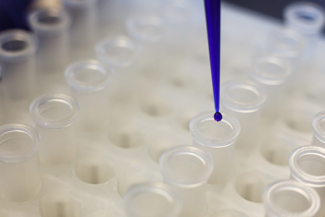 RNA-targeting strategy successfully blocks a vexing driver of Parkinson’s disease