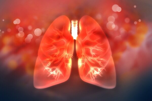 Calibr works with Cystic Fibrosis Foundation to find potential medicines for hard-to-treat lung infections