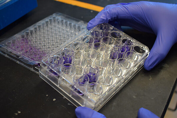 Editing cancer-causing RNA delivers precision strike on triple-negative breast cancer