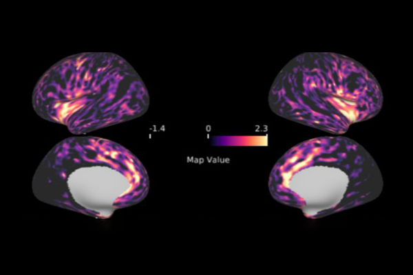 Scripps Research spin-off BlackThorn Therapeutics advances lead clinical program for major depressive disorder