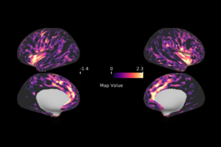Scripps Research spin-off BlackThorn Therapeutics advances lead clinical program for major depressive disorder