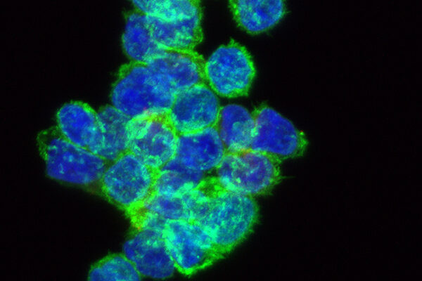 Calibr’s ‘switchable’ CAR-T platform for cancer moves forward with FDA clearance of Investigational New Drug application