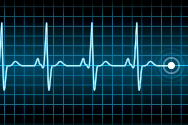 As fitness wearables near ubiquity, resting heart rate poised to become ‘vital sign of the digital age’